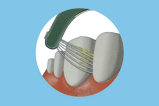 Technologie Buletedan